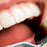 Diş eti kanaması orucu bozar mı?