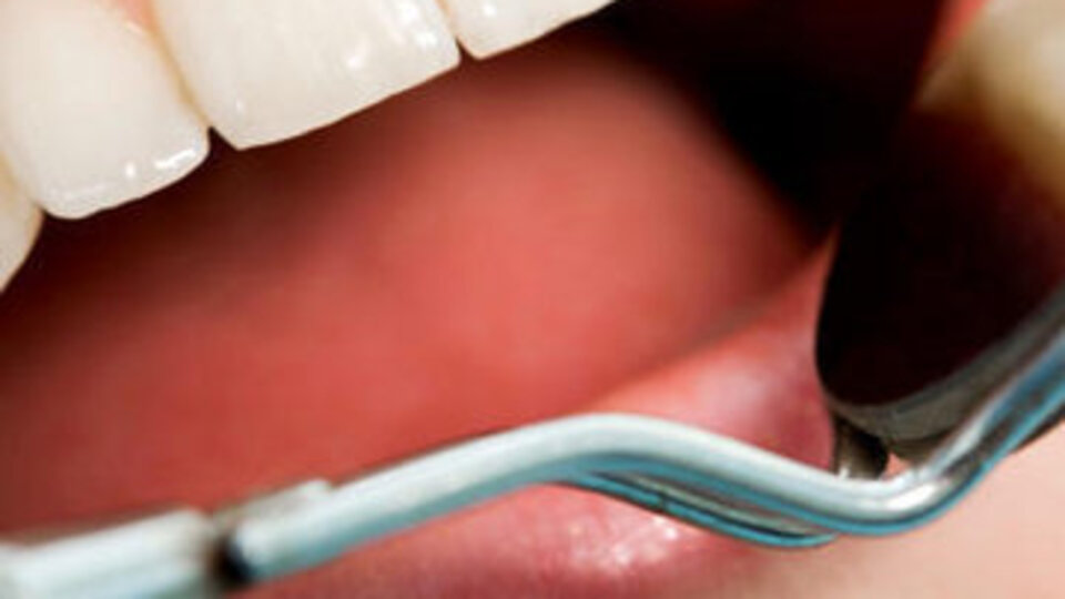 Diş eti kanaması orucu bozar mı?