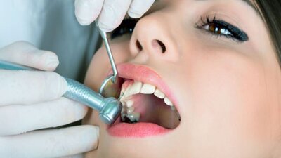 Diş çektirmek orucu bozar mı?