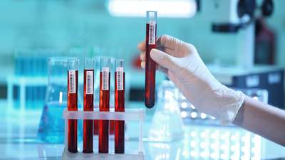 Evlilik öncesi yapılacak! 81 ile yaygınlaştırıldı