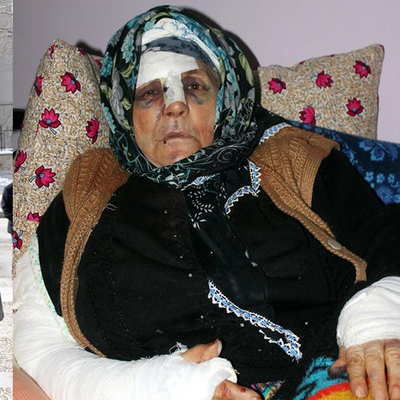 Yaşlı kadına sopalı vahşet!