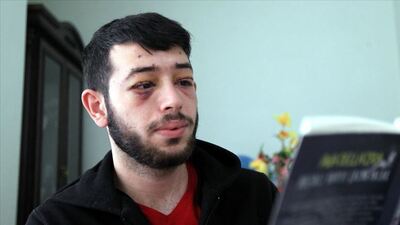 İş bulmaya göz kapağı engeli!