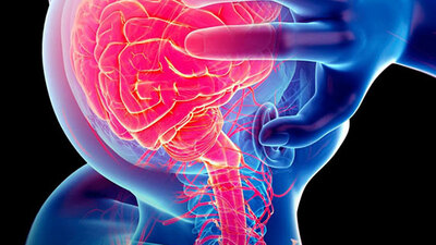 Epilepsi nedir, nasıl tedavi edilir?