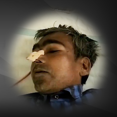 Metal yiyor! Midesinden çıkanlar şoke etti!