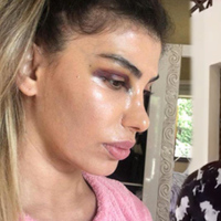 'Gözüne yumruk yedi' iddiasına yanıt