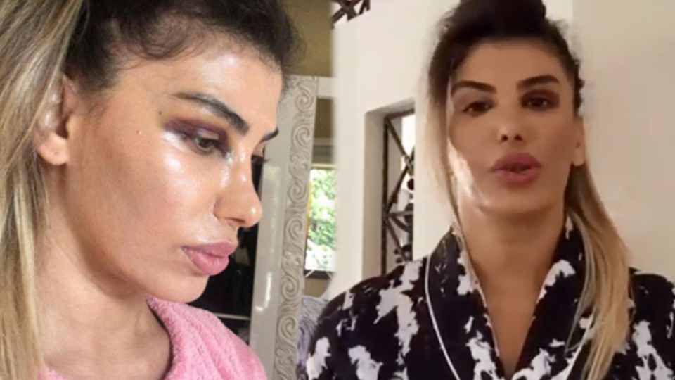 'Gözüne yumruk yedi' iddiasına yanıt