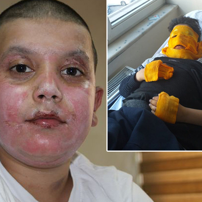 Sprey kutusu patladı! Feci şekilde yandı