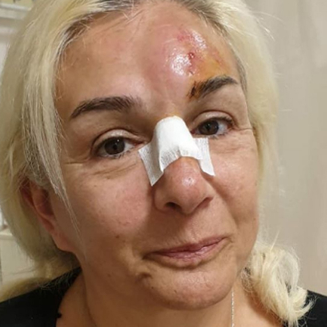 "Kim nazar ediyorsa çeksin gözlerini üzerimden"