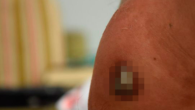 Ameliyatı beklerken dışarı fırladı!