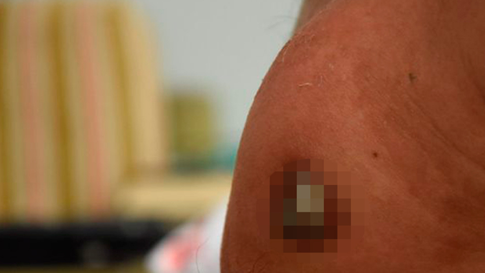 Ameliyatı beklerken dışarı fırladı!