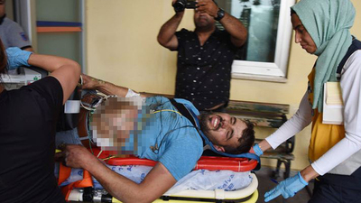 Oltası elektrik tellerine takıldı!