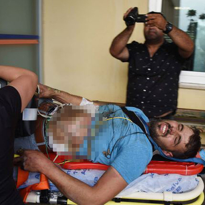 Oltası elektrik tellerine takıldı!