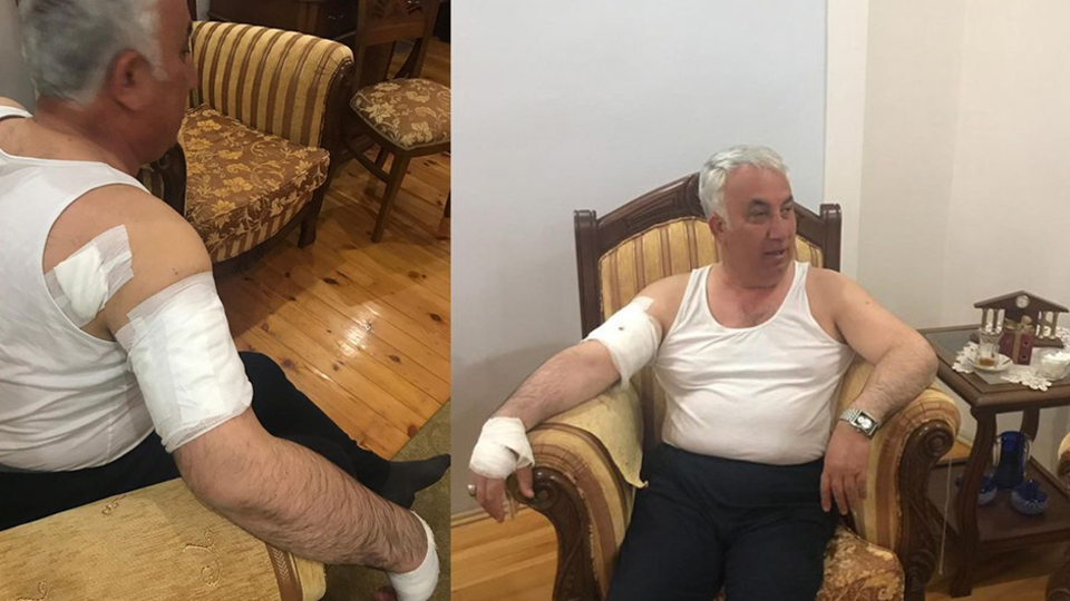 Başkana köpek saldırdı!