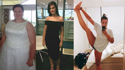 Kilolarından kurtulmak için ameliyat oldu, 80 kilo verdi!