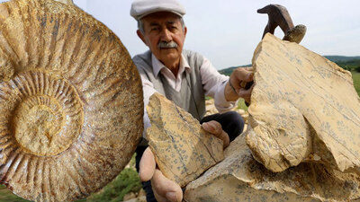 "Hastalıklarımı böyle yendim"