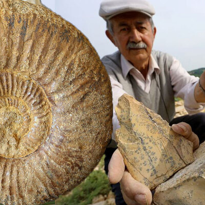 "Hastalıklarımı böyle yendim"