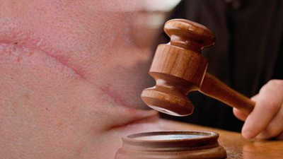 Yargıtay'dan 'scar face' kararı!