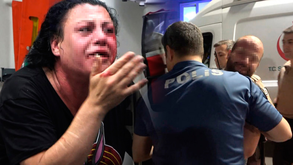 Eskort sitesinden konuştu! Transseksüel olduğunu öğrenince...