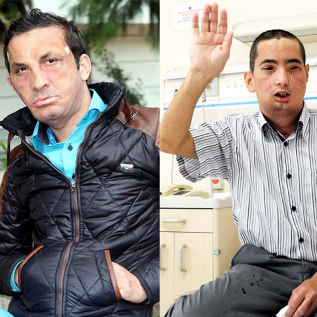 Nakillerle değişen hayatlar!