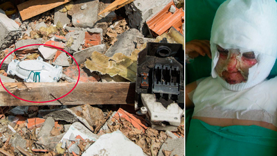 Molozların arasında oynuyordu! Şimdi ne yemek yiyebiliyor, ne konuşabiliyor