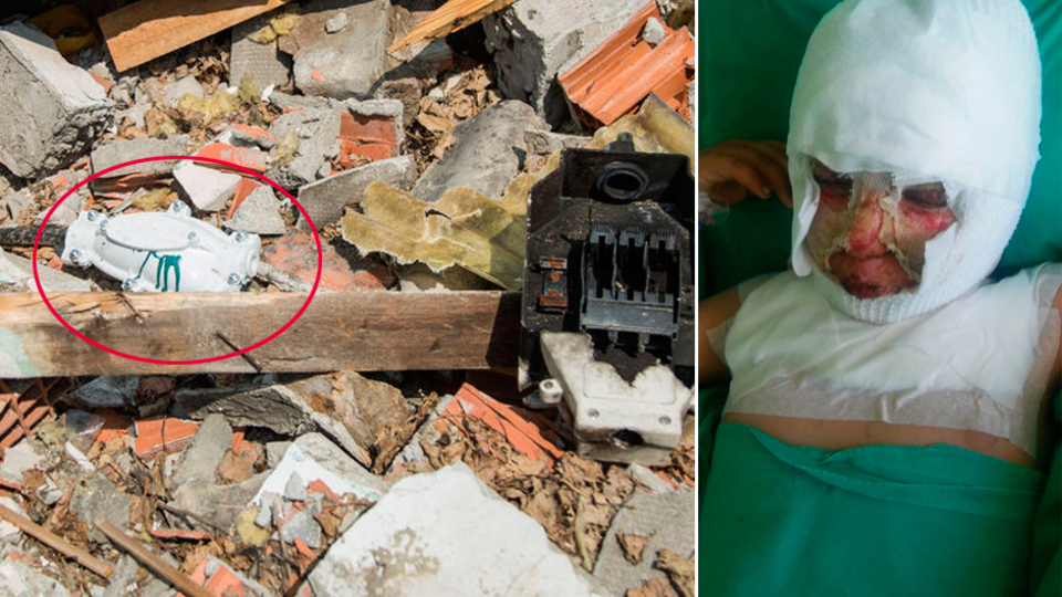 Molozların arasında oynuyordu! Şimdi ne yemek yiyebiliyor, ne konuşabiliyor