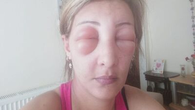 Saçlarını yaptırmak için kuaföre gitti, ölümden döndü!