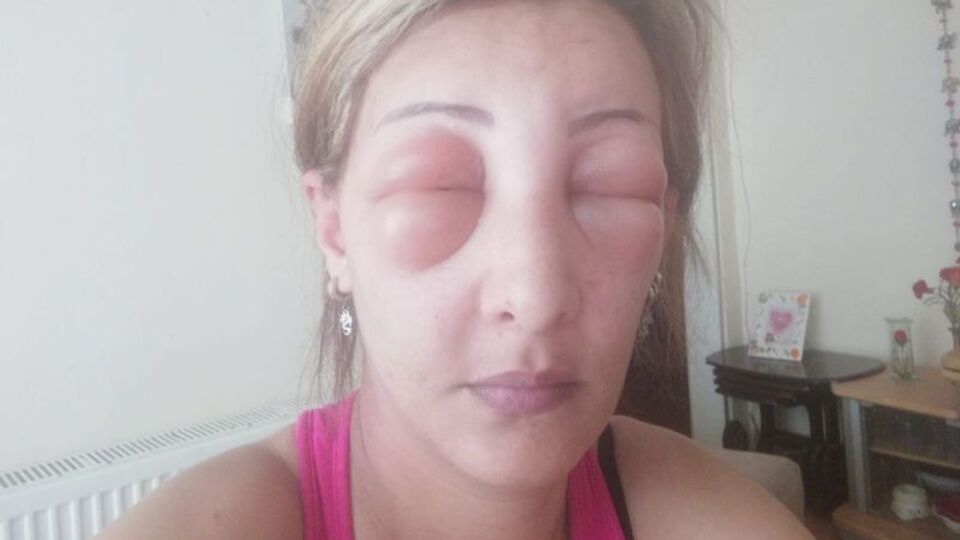 Saçlarını yaptırmak için kuaföre gitti, ölümden döndü!