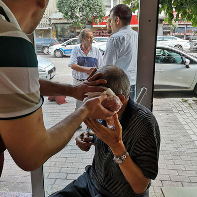 Yaralıya kasap usulü tedavi