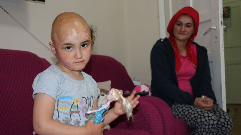 Kızgın yağ döküldü hayatı karardı!