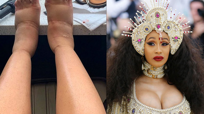 "Ayaklarımın ne kadar şiştiğine bakın"