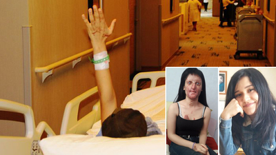 Berfin'in ameliyatı 10 saat sürecek!