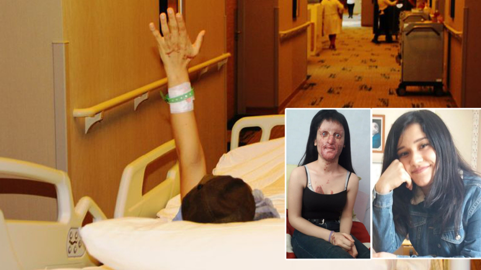 Berfin'in ameliyatı 10 saat sürecek!