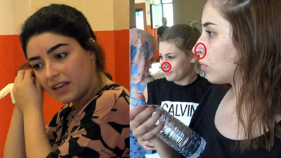 Basit piercinge uymayan sınava giremedi! Basit piercing tanımına dikkat!