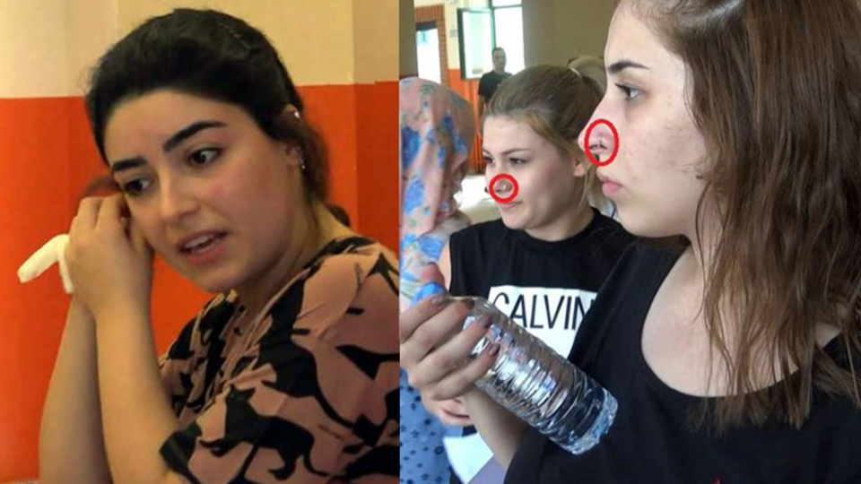 Basit piercinge uymayan sınava giremedi! Basit piercing tanımına dikkat!