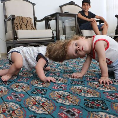 Siyam ikizleri 1 yaşında!