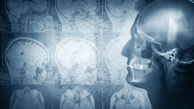 Bu alışkanlıklar beyni yaşlandırıyor!