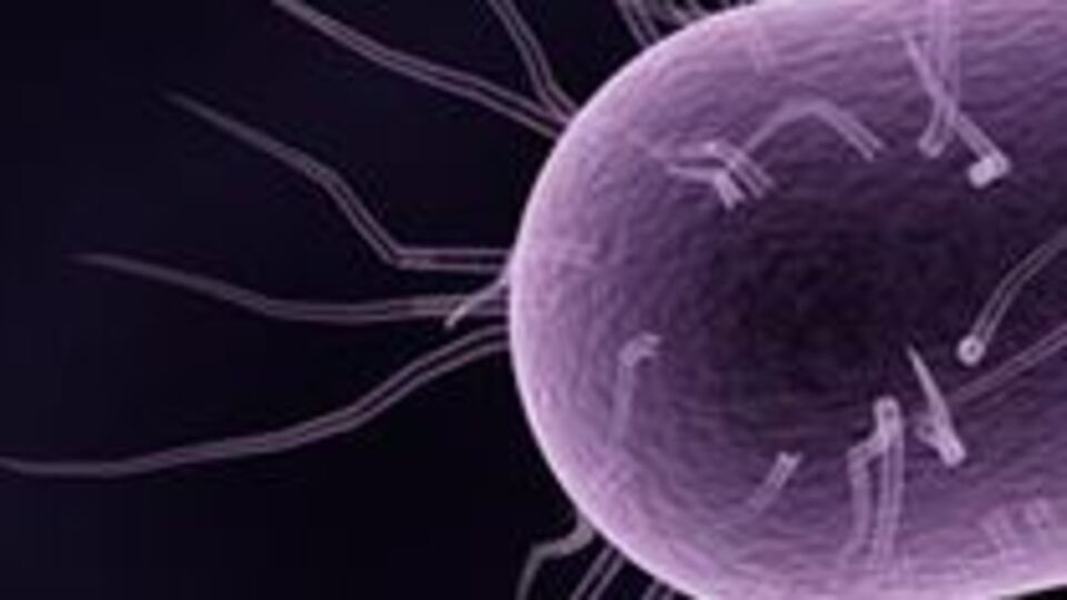 İngiltere'de bakteri can aldı