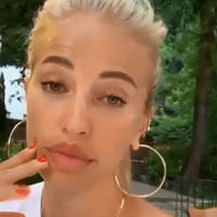 "Ne dolgu var ne botoks"