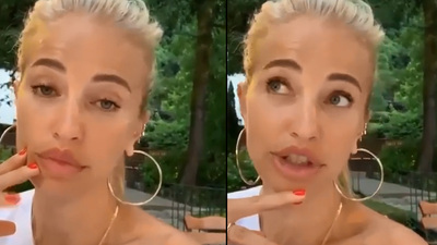 "Ne dolgu var ne botoks"