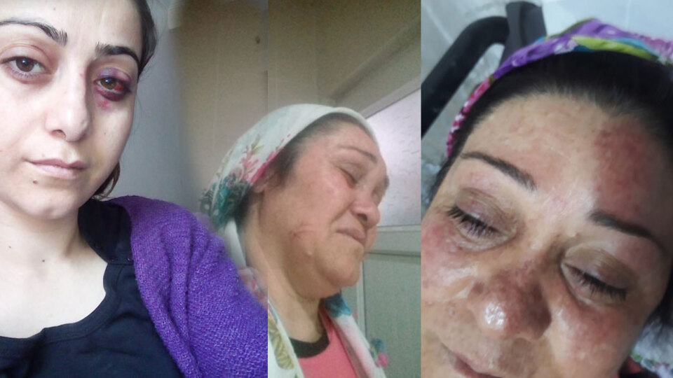 Boşanmak isteyen eşini darp etti