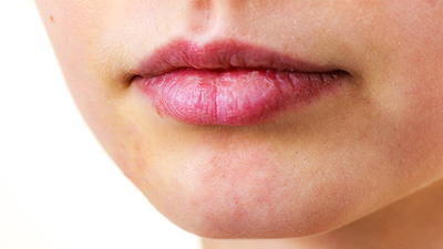 O meslek grubu dudak kanseri riski altında!