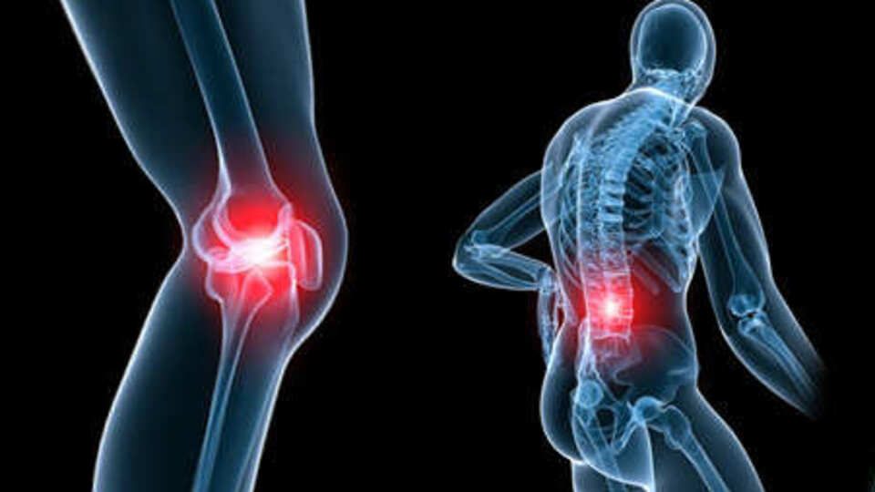 Adale romatizması (Fibromiyalji) nedir?