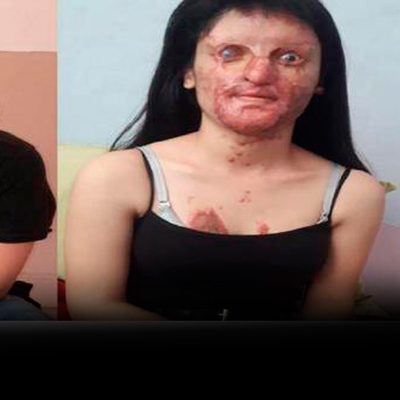 Berfin'in yüzüne asitle saldıran sanık hakim karşısında