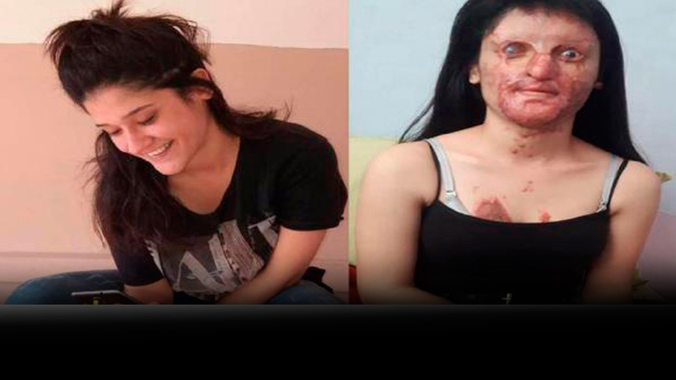 Berfin'in yüzüne asitle saldıran sanık hakim karşısında