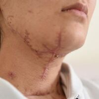 Sevgilisini bıçaklayıp göl kenarına atan sanık hakim karşısına çıktı