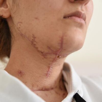 Sevgilisini bıçaklayıp göl kenarına atan sanık hakim karşısına çıktı