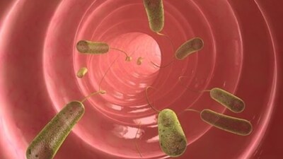 Bağırsak parazitleri nedir?