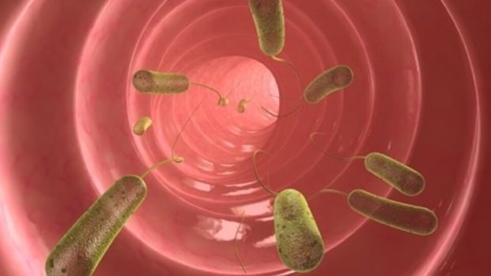 Bağırsak parazitleri nedir?