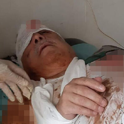 Terörist Mihraç Ural, patlamada yaralandı