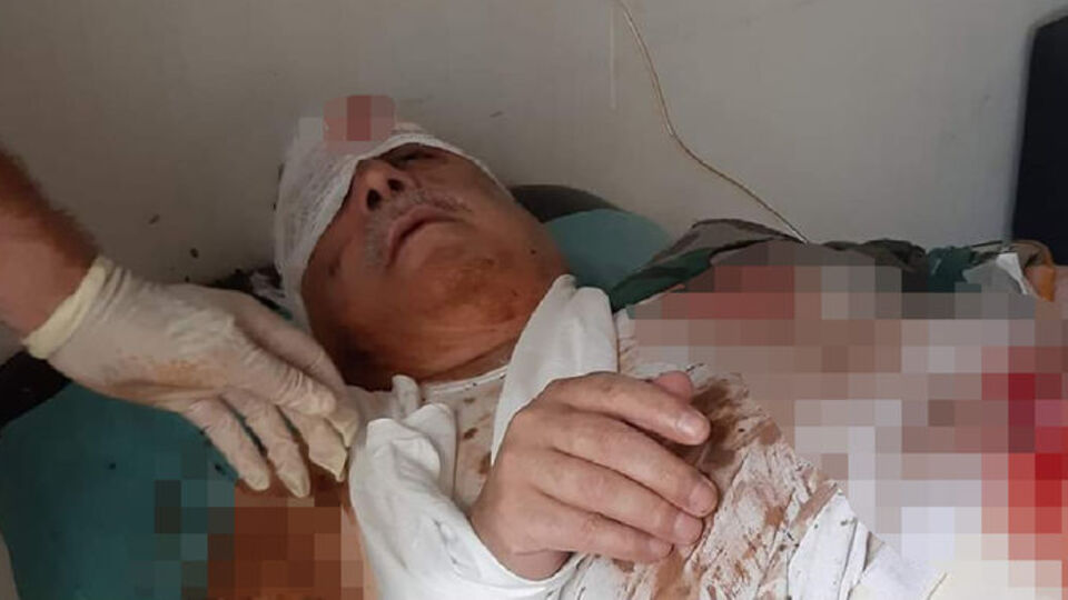 Terörist Mihraç Ural, patlamada yaralandı